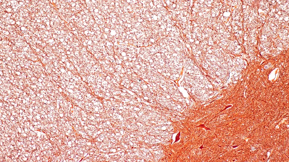 Cerebellum, Thalamus, Medulla oblongata, Spinal cord and Motor Neuron human under the microscope in Lab. Orange colours