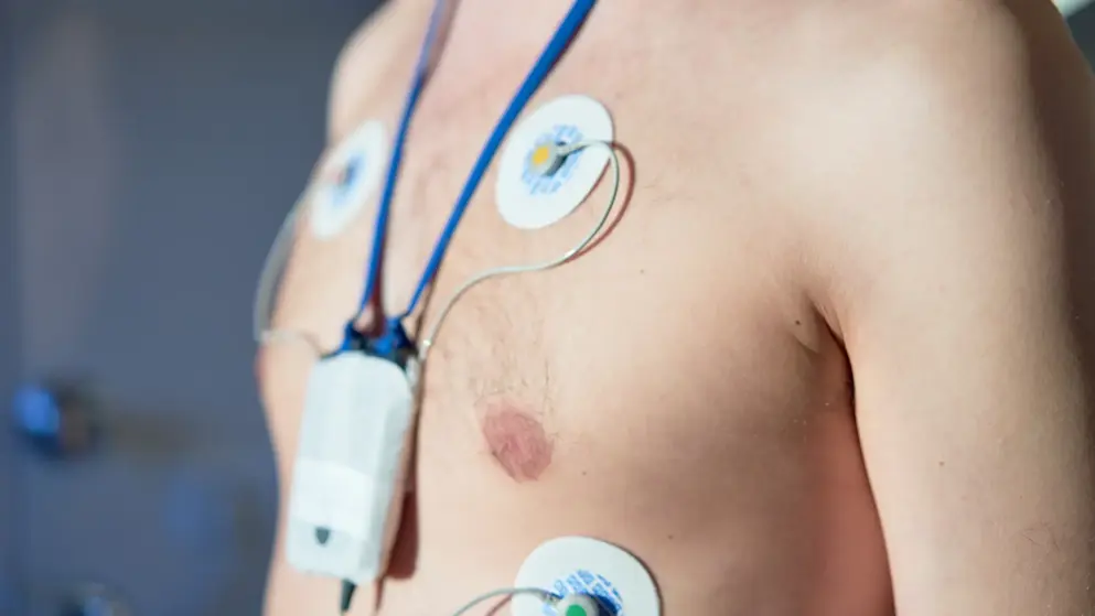 Young man being tested for atrial fibrillation with an ECG and portable monitor