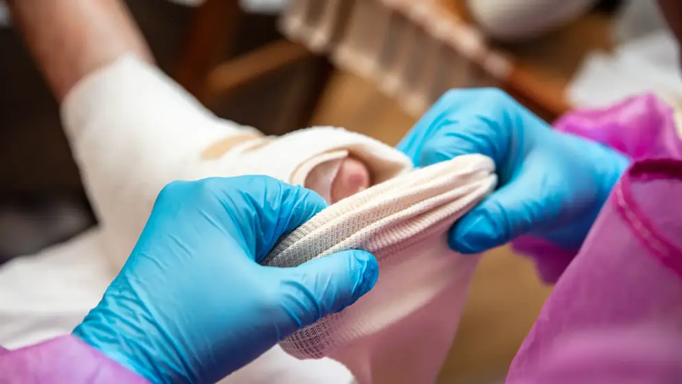 Image of a foot with epidermolysis bullosa being wrapped in soft bandages