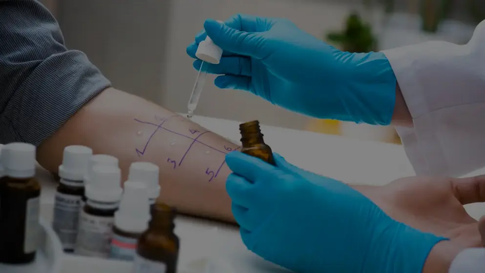 The underside of a person's forearm, split into a grid with pen marks; a doctor drips a solution into each segment; a skin prick test